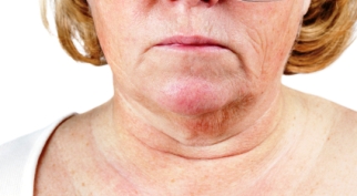 neck wrinkle skin turkey sagging wrinkles fix creams integumentary system hide older cream makeup rid worse age dehydration easy facial