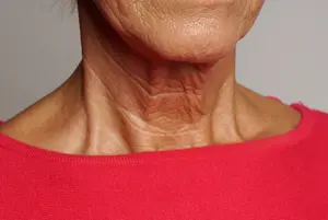 older womans neck  