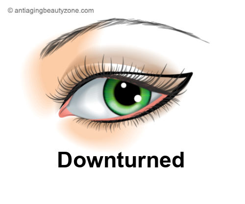 Downturned Eye Shape.