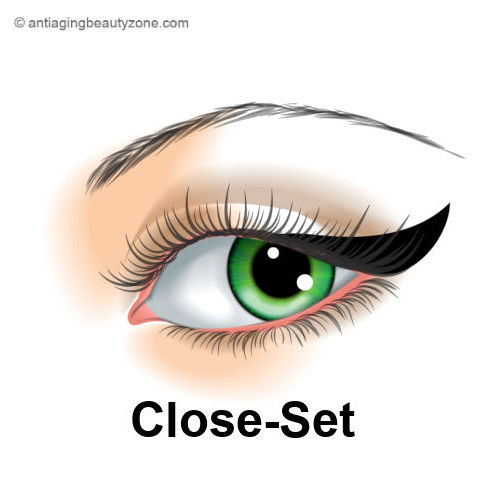 Close-set eyes.