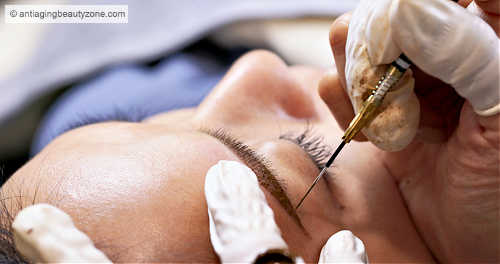 Close-up of a mature woman getting eyebrow tattoo microblading treatment for fuller, defined brows.