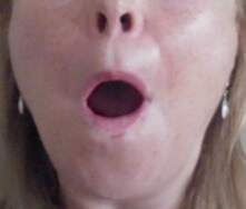 step 1 for cheek exercises