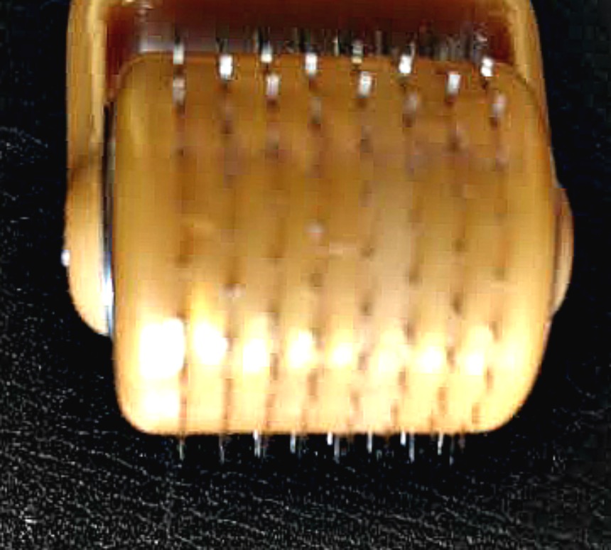 close-up of derma roller needles for facial skincare