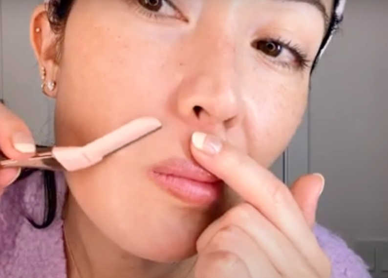 Is dermaplaning a good idea? Yes, it removes dead skin cells and facial hair. A woman dermaplane her upper lip. Does dermaplaning smooth skin? Yes.