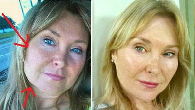 Face Exercises Do Work!