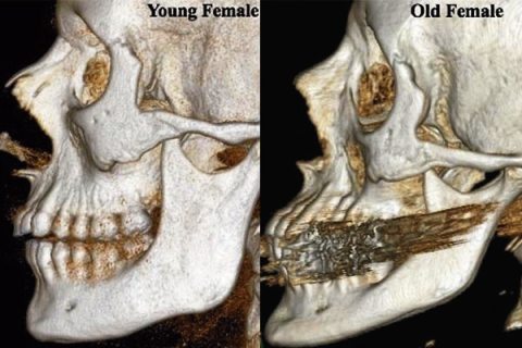 Can Face exercise change facial bone structure?