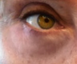 prevent under eye bags