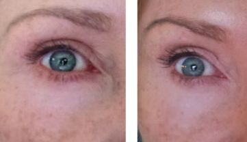 aging eyes and dark circles - before and after highlighter crayon beauty tips for aging eyes before and after highlighter crayon