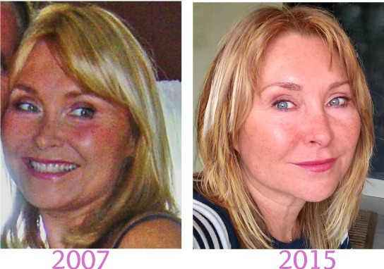 face slimming exercises before and after after time