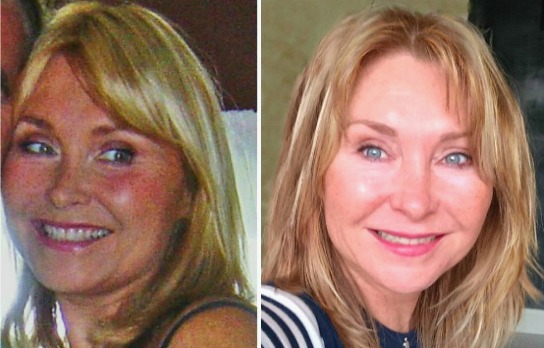 Facial fitness before and after results. Pictures of my before and after doing facial fitness exercises.