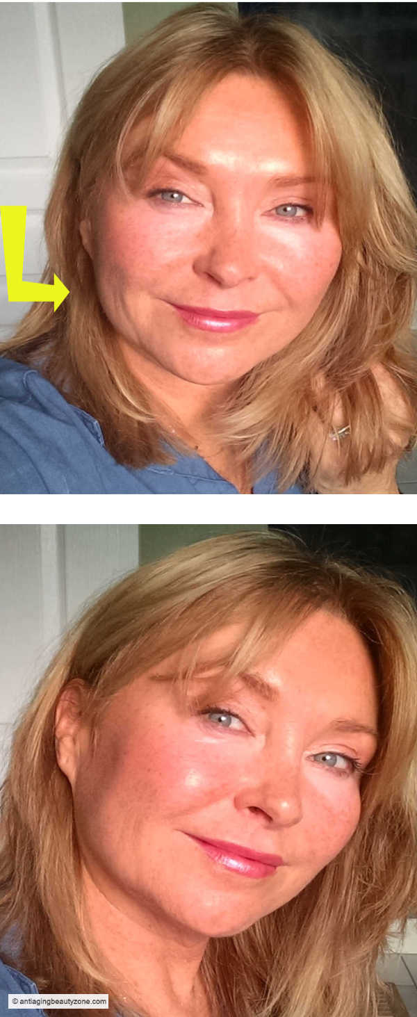 Before & After Kansa Wand – Facial Massage Results & Skin Benefits. Before and after using the Kansa wand – facial massage results showing a lifted and smoother appearance.
