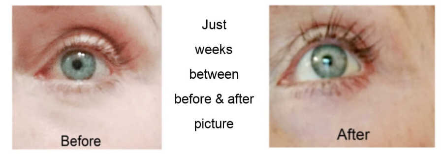 best over-the-counter lash growth serum before and after.