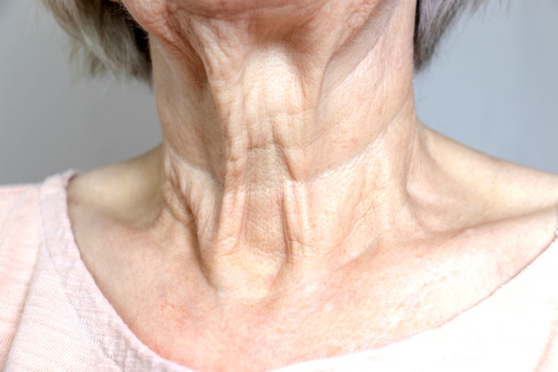 Sagging Neck: Causes & How to Tighten. 7 Non-Surgery & Home Tips