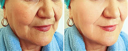 Why makeup looks crepey and wrinkled? Makeup before and after.