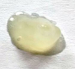 Photo of preparation H under eye puffiness.