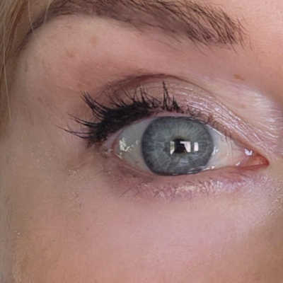 Peter Thomas Roth FirmX under-eye result after about 8 hours, still looking fairly smooth with slight cracking near the outer corner