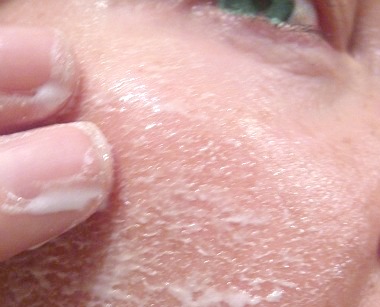 Scrubbing my skin with Renewing MicroDermabrasion Complex cream anti-aging facial treatment