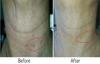 turkey neck and brown skin spots