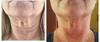 My turkey neck exercise before-and-after results