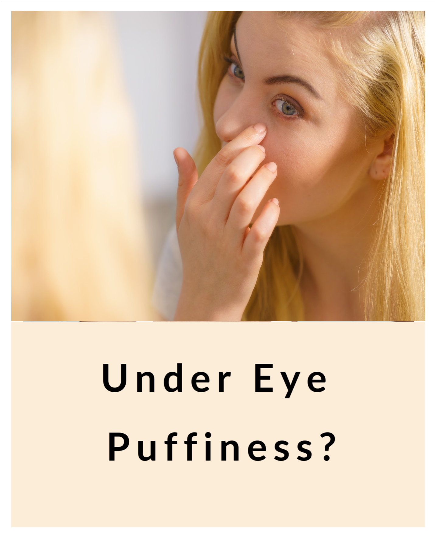 Woman touching under eye puffy skin