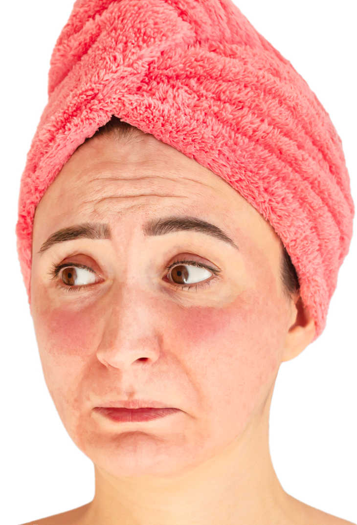 Slugging for rosacea is not for everyone. woman looking upset