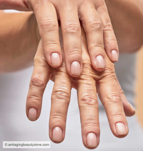 Why Are My Hands Wrinkled? Causes and Solutions. Wrinkled hands showing signs of aging, with focus on care and treatment options.