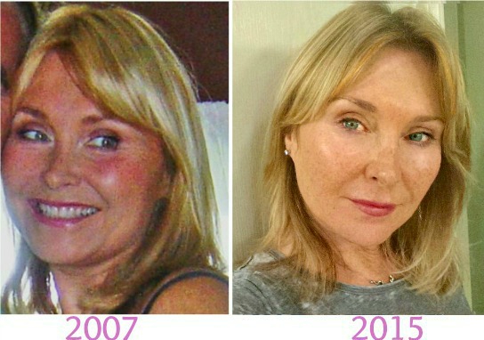 face slimming exercises before and after under skin