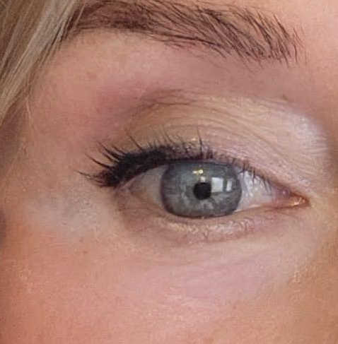 Plexaderm under-eye result during an 8-hour wear test compared with Peter Thomas Roth FirmX