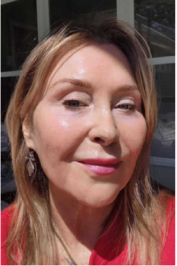 powder vs tinted sunscreen on face showing natural finish in sunlight